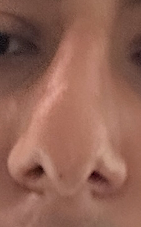 IMG 2436