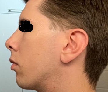 alotustilanne.png