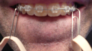 Image 4 Image 4