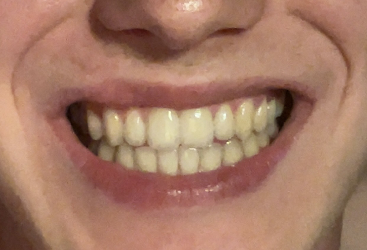 IMG 2450