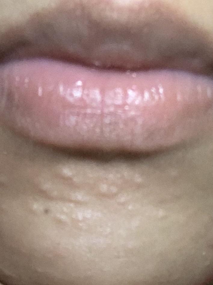 IMG 5669