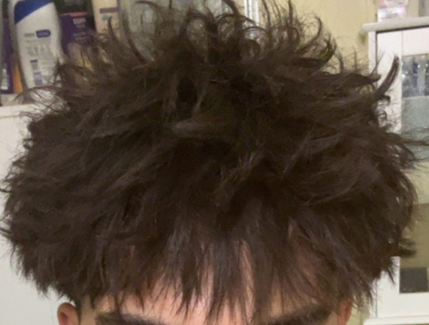 1000007633