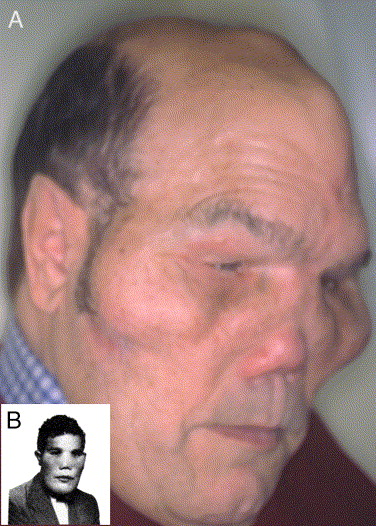 1 s20 S0196070905000098 gr1