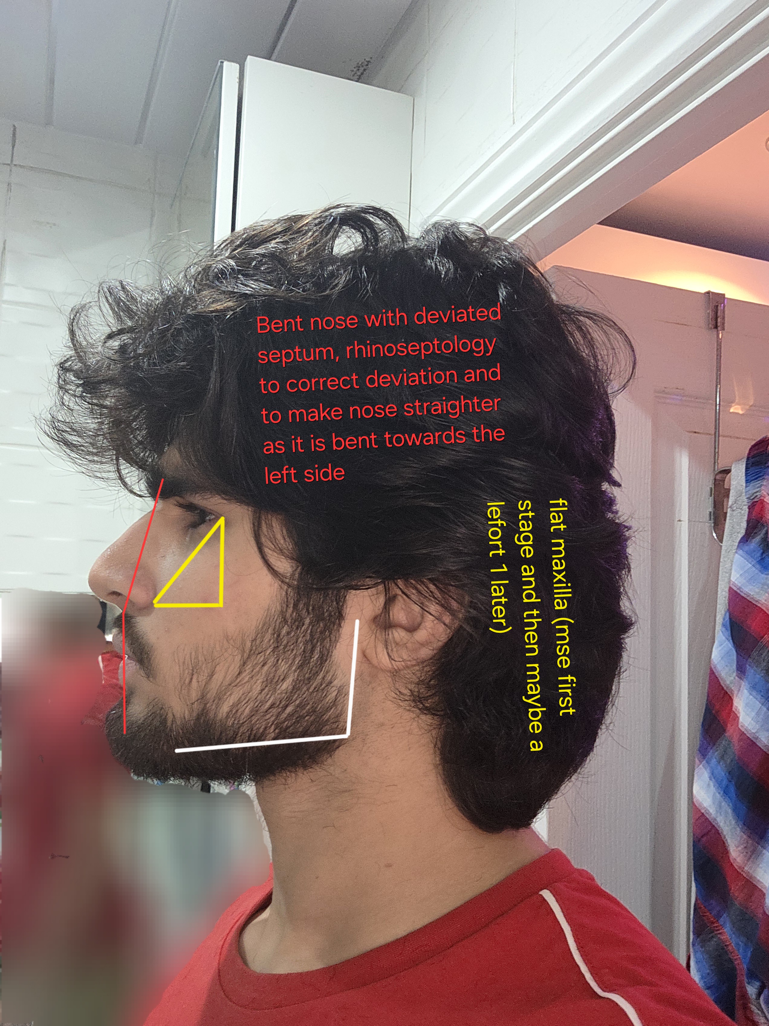 20250802 205027