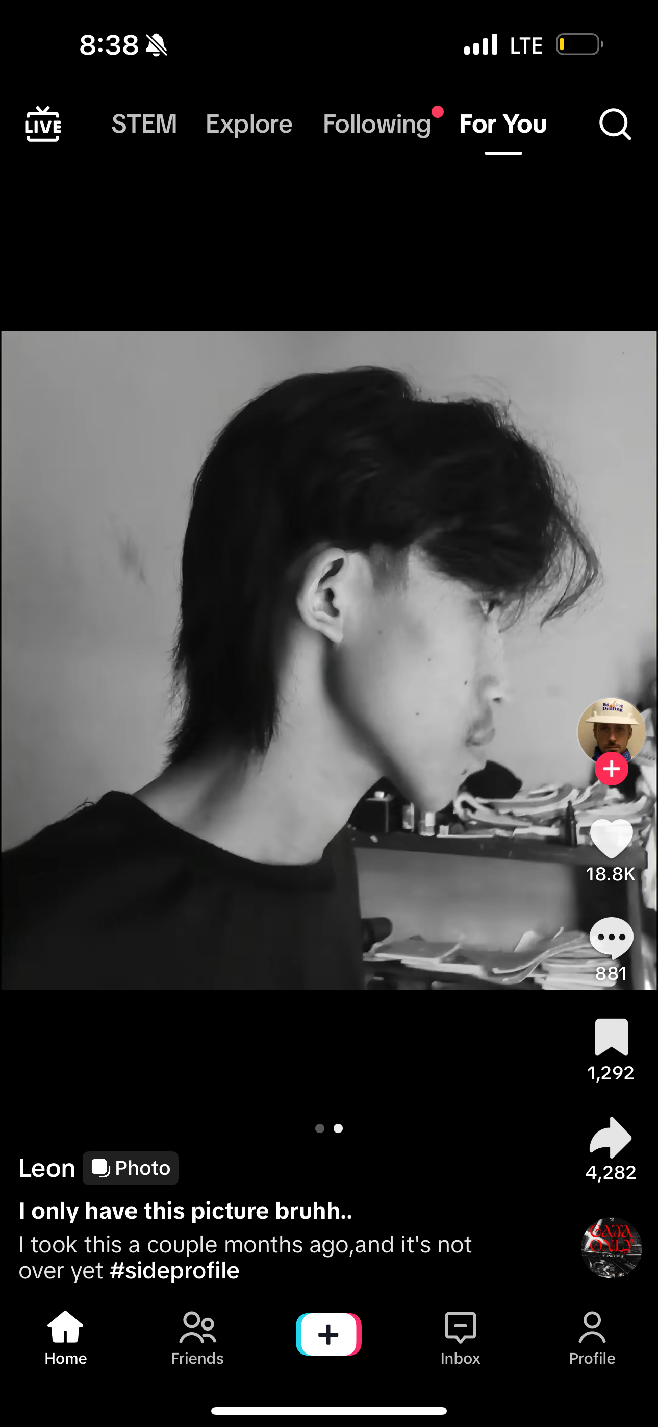 Most brutal side profile ever | Looksmax.org - Men's Self-Improvement ...