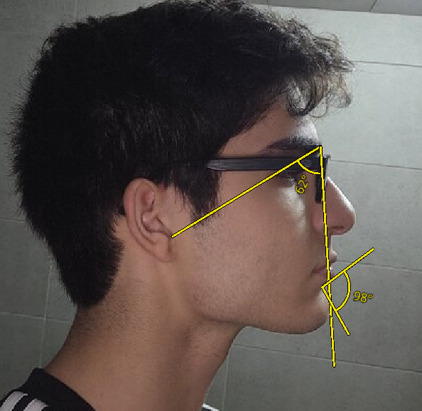 1754260035222