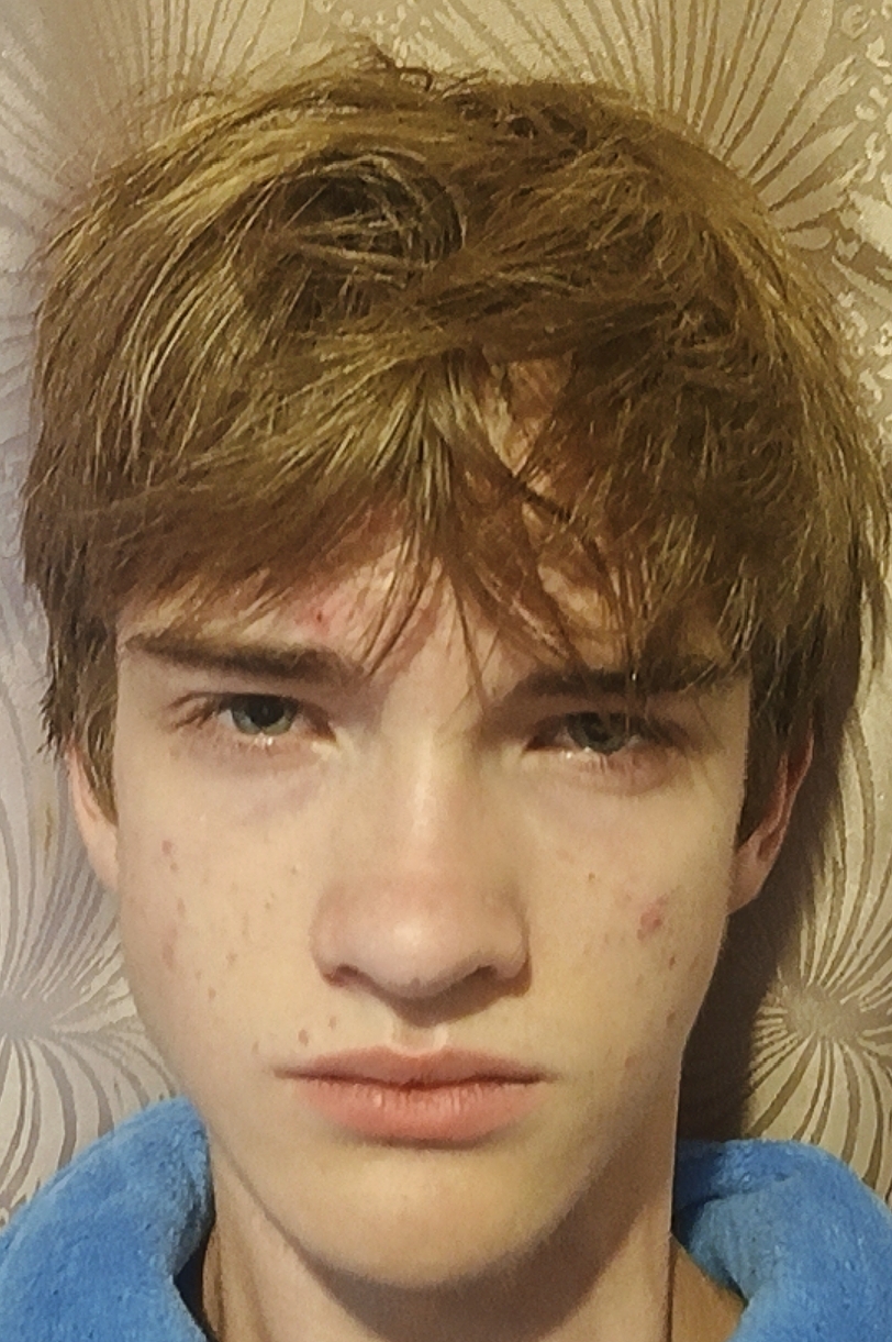 1000038226