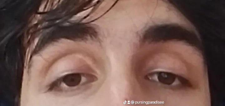 1000011522