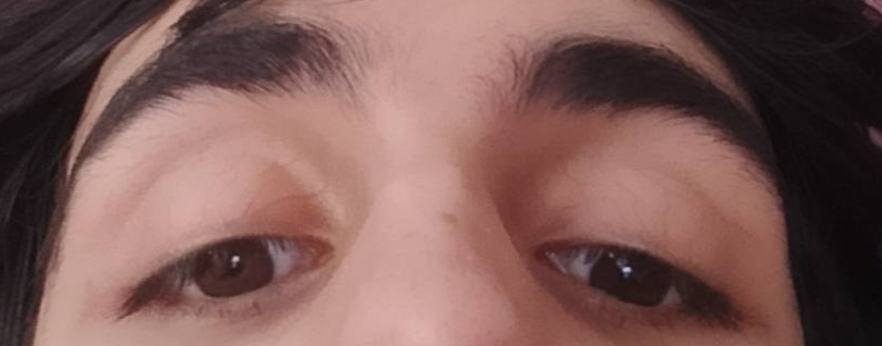 1000011526