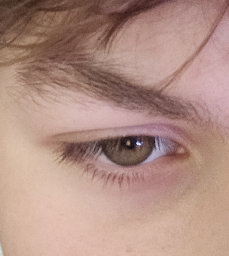 1000047114