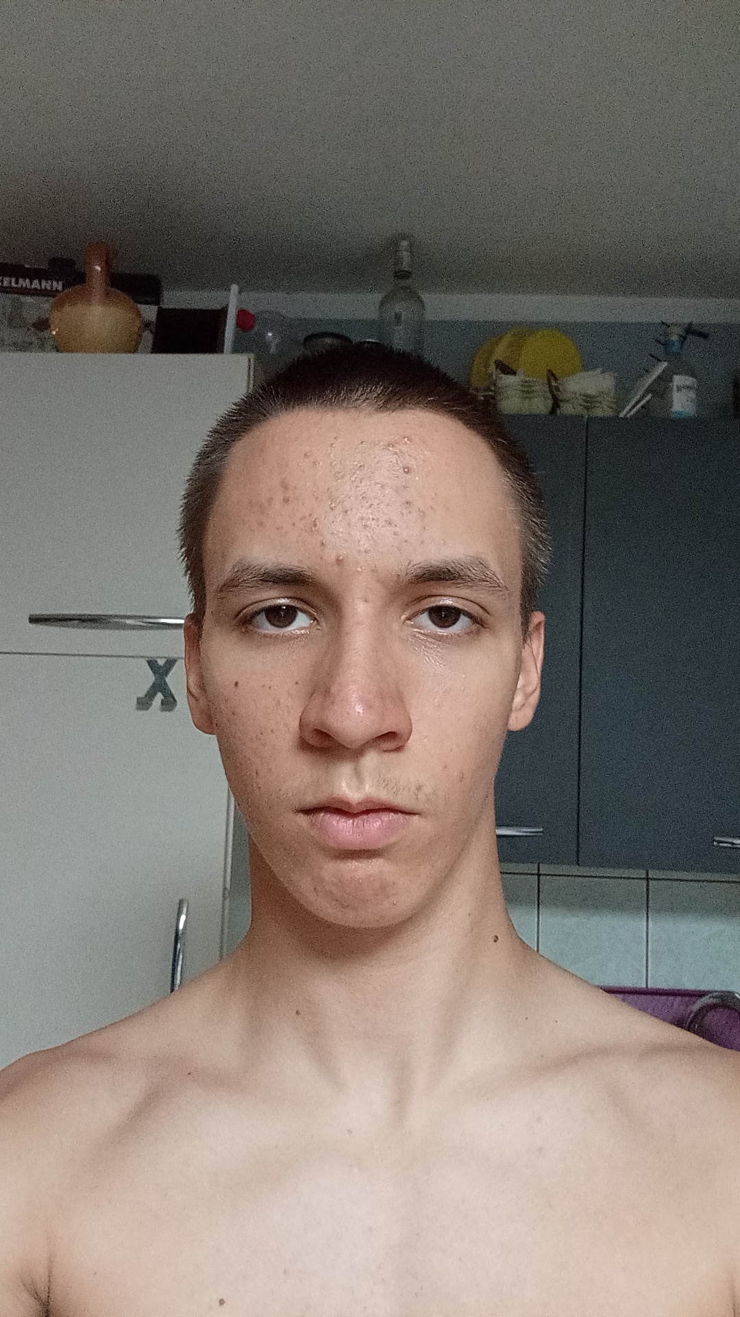 1000010681