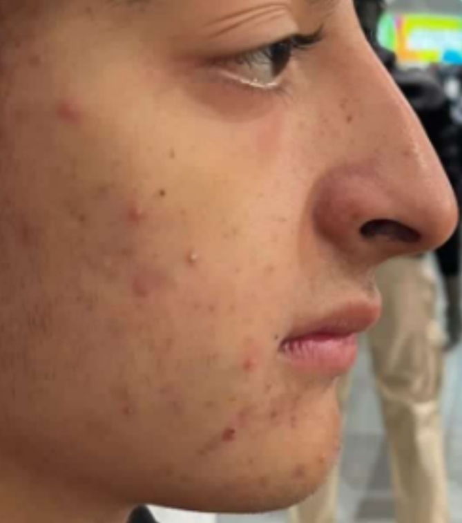 IMG 20250811 051951