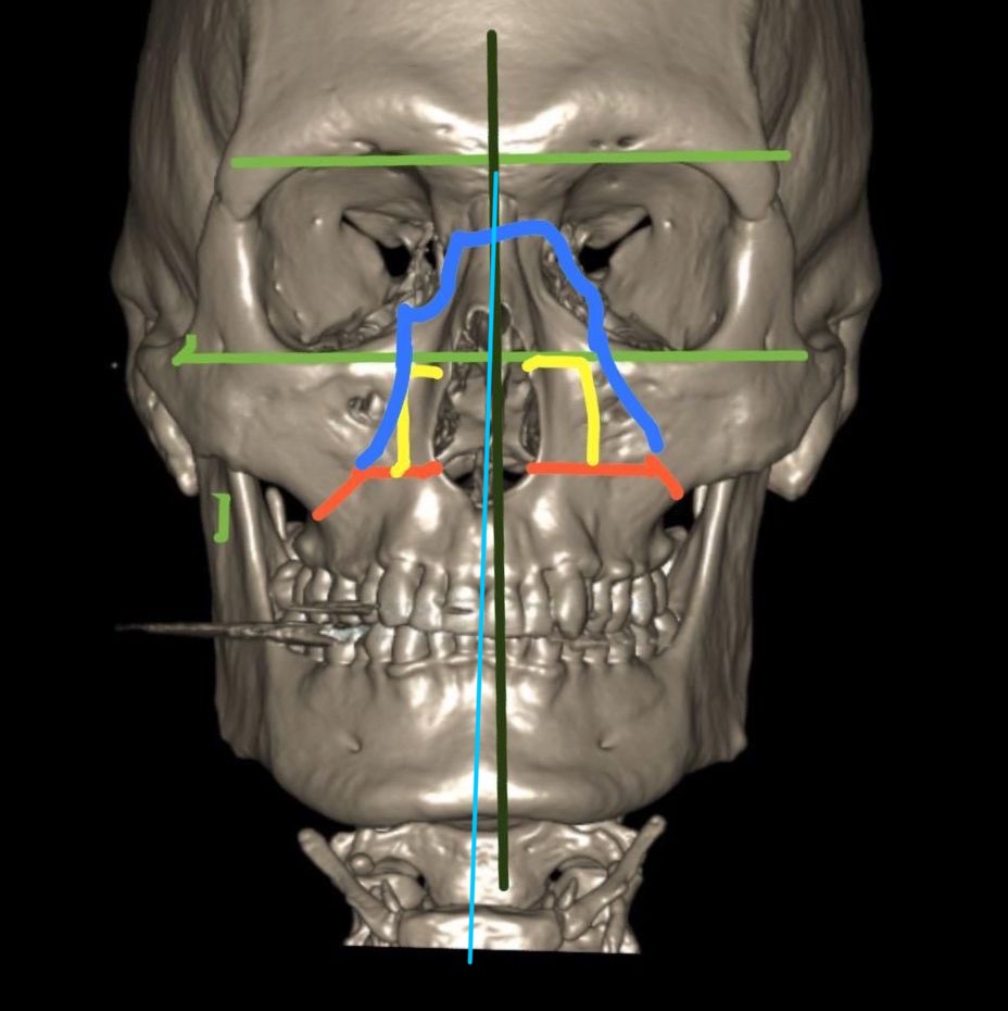 A1673886 dec0 4a21 995f 4ba399cba71f