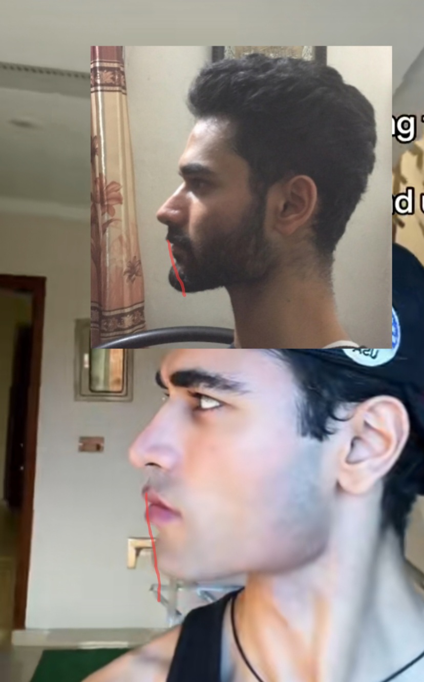 Screenshot 20250814 053402 TikTok