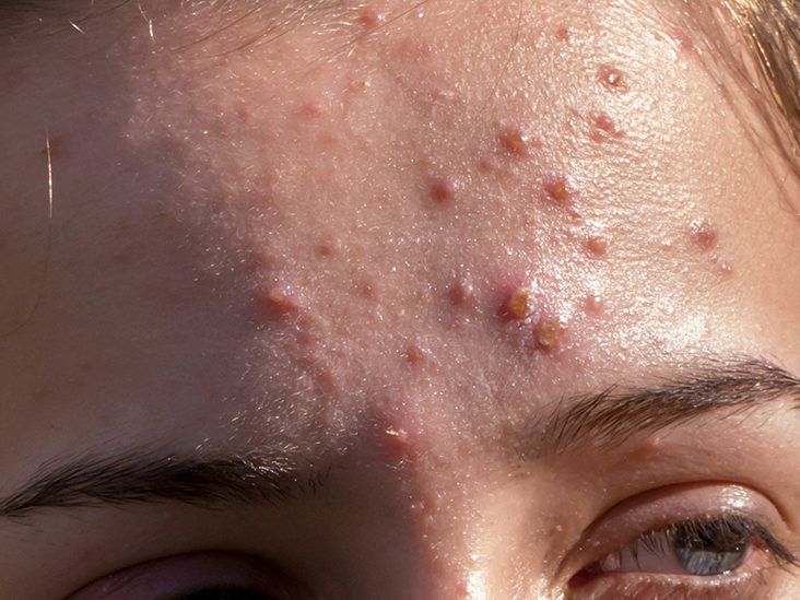 GettyImages 552992761 thumb 732x549