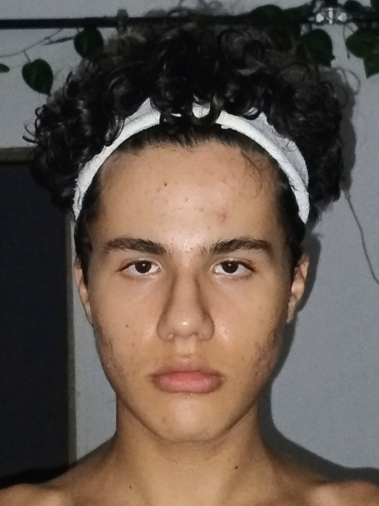 Face