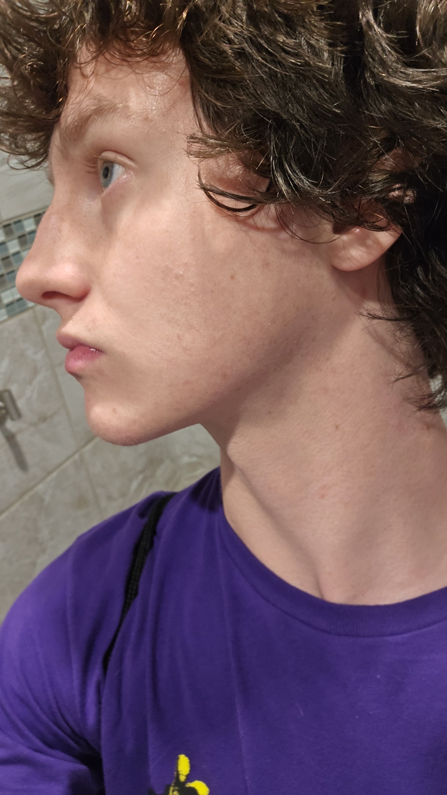 1000027305
