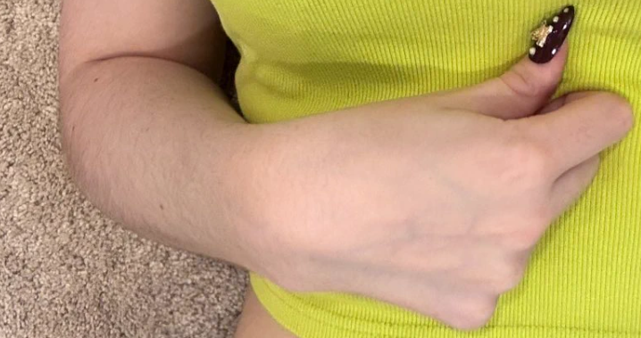 Arm