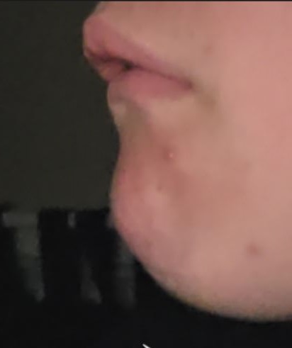 Xx