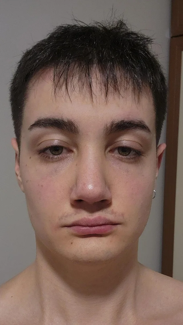 Fff