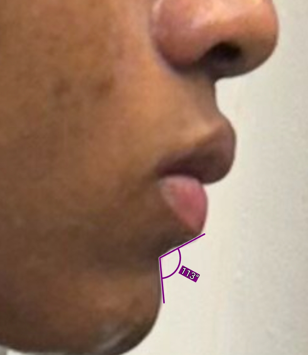 1000023825