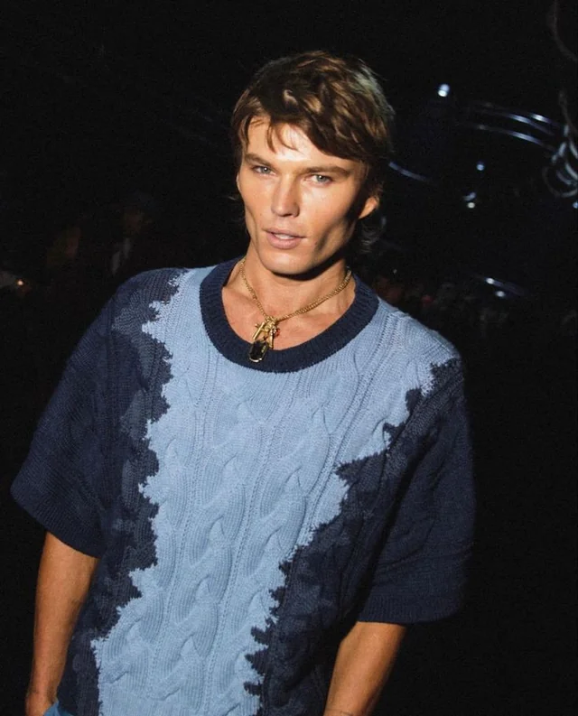 Jordan barrett before and after plastic surgery slide 7 12 v0 v8ygutewwxxd1