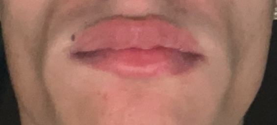 IMG 2382 IMG 2382