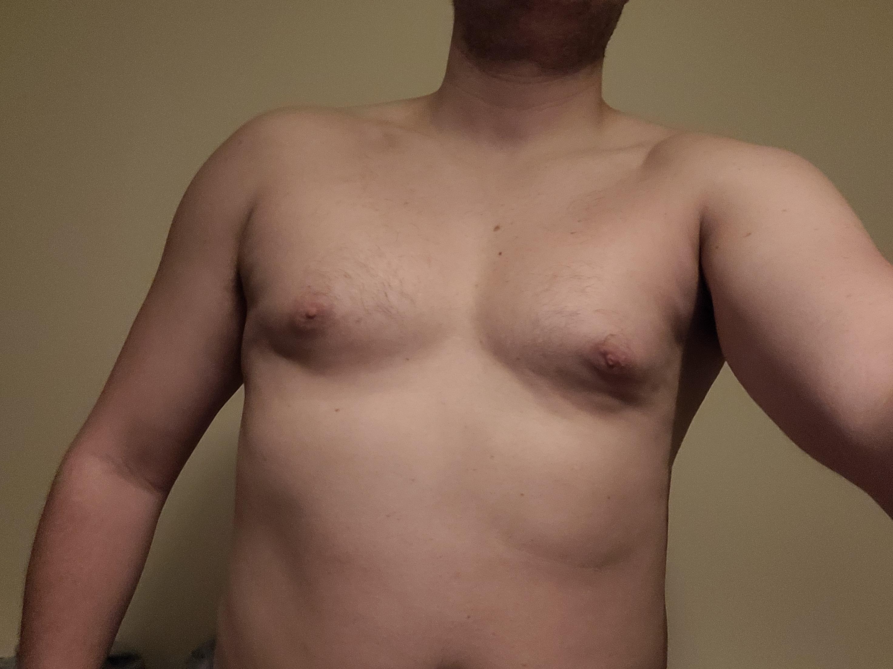 Gyno or just still too fat v0 pa0yevvfwseb1