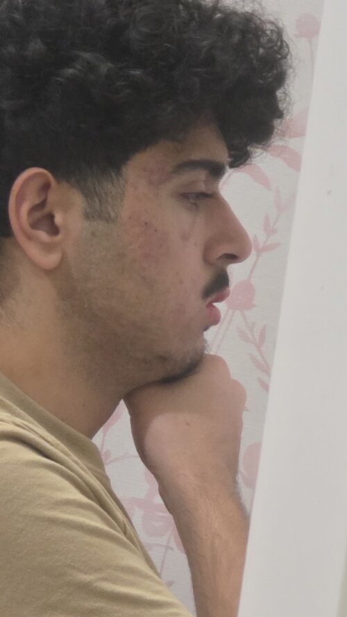 1000007070.jpg