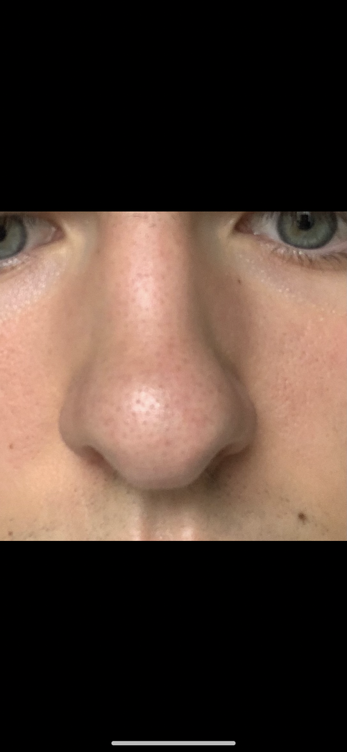 IMG_6347.png