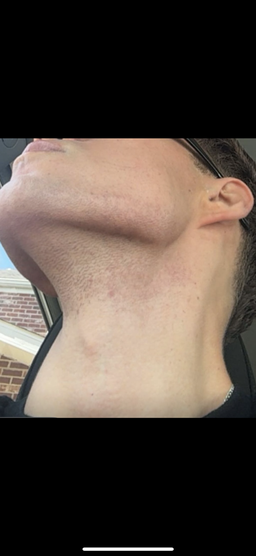 IMG 1391