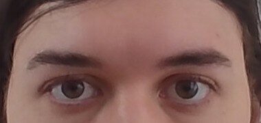 eye 09 aug.jpg