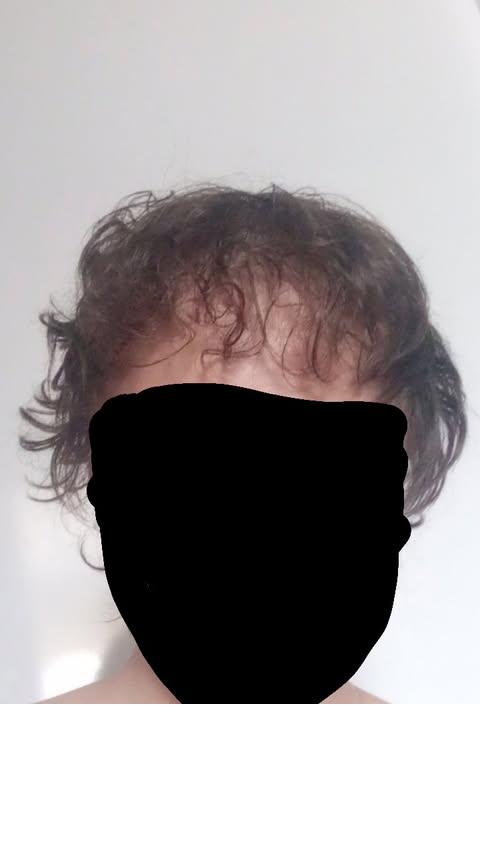 1 ama kesik.png