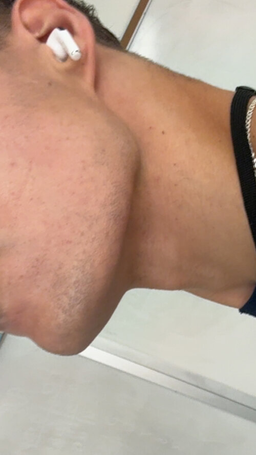 IMG 1615