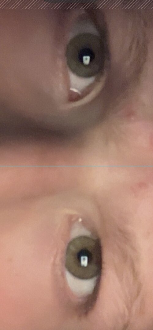 eye.jpeg