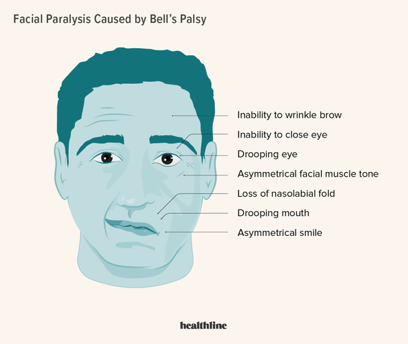 face.webp
