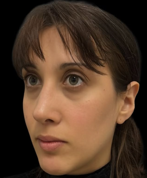 de2.png