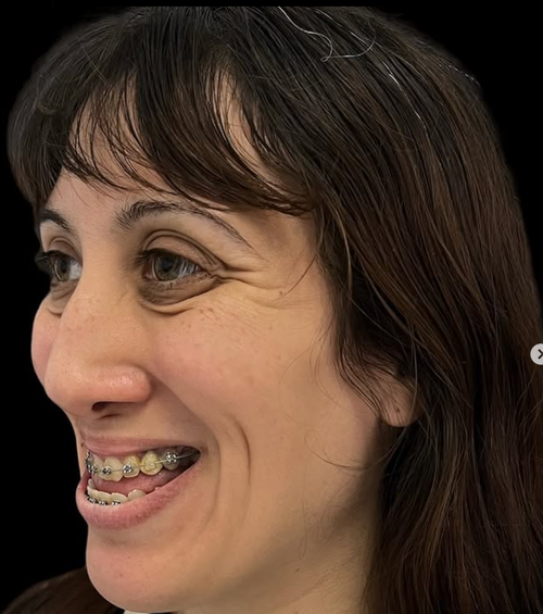 jfl.png