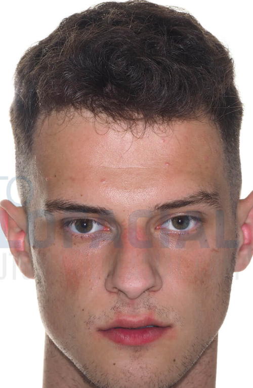 brdc.png