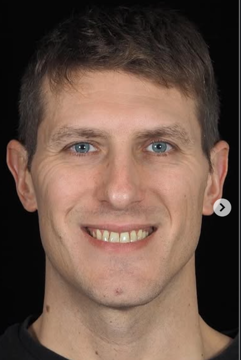 55.png