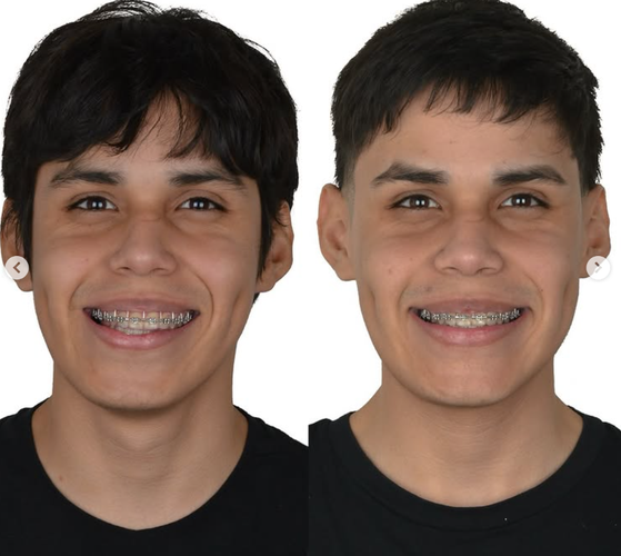 1756608269138.png
