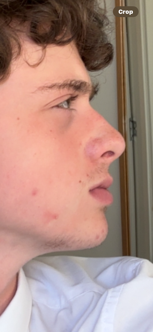 IMG 0768