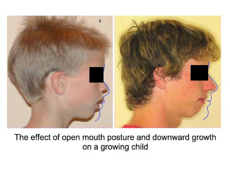 Orthotropic treatment Cork Orthotropic treatment Cork
