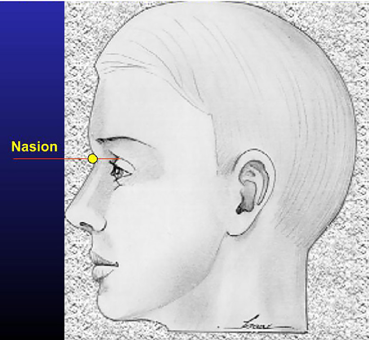 Nasion region profile view