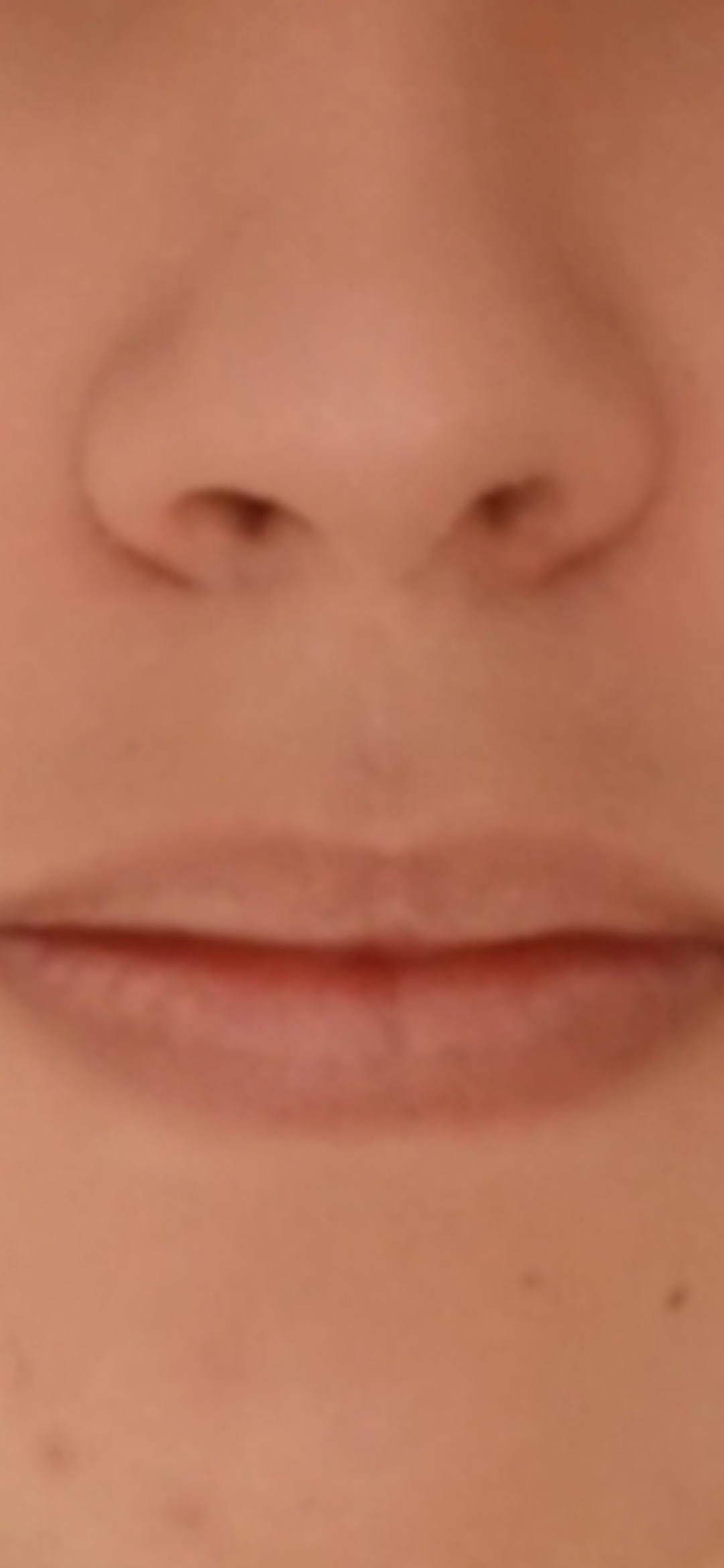 1000091578 1000091578