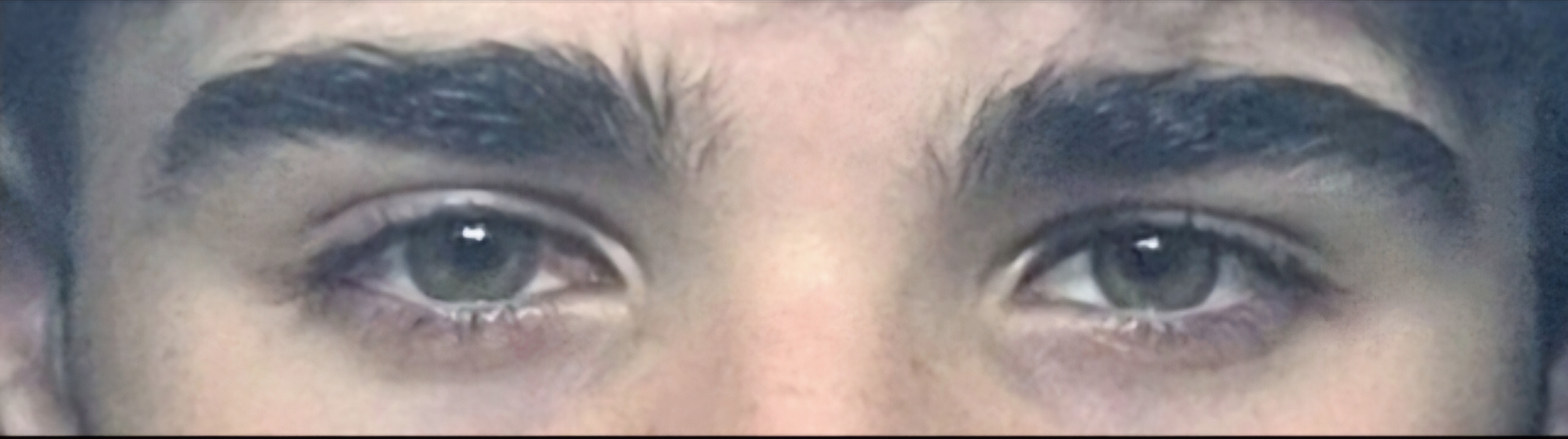 1000242849 1000242849