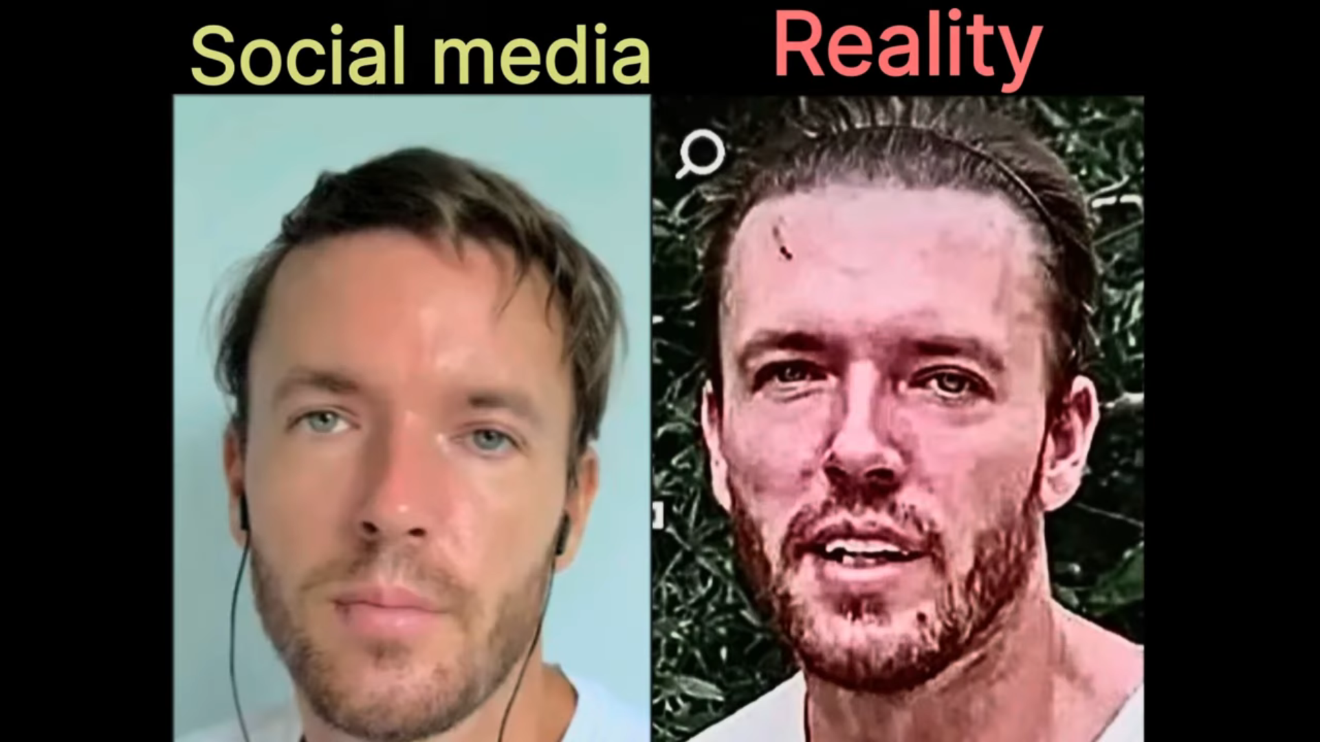Sub 5 skin quality