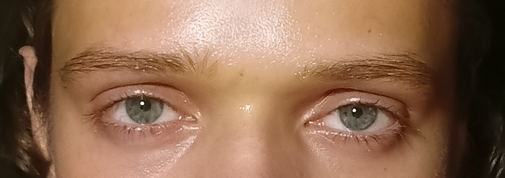 1000020760
