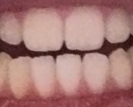 IMG 0526