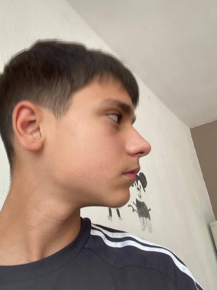 1000003025